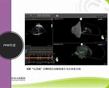 包含顶尖球员百尺竿头更进一步,向卓越冠军冲刺的词条
